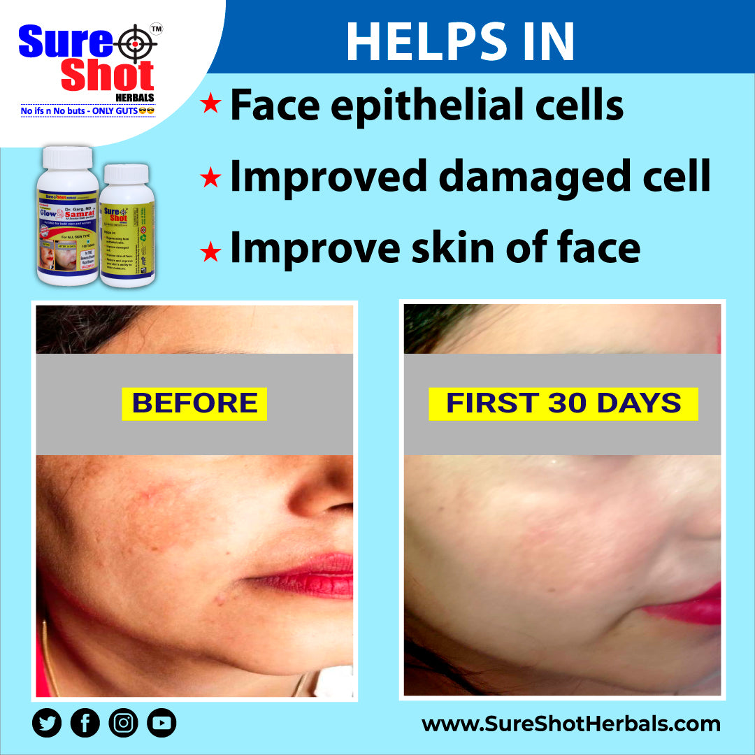 Dr.Garg's M.D. - Glow Samrat Tablets (100 Pcs) For Regenerating Face Epithelial Cell, Improve Damaged Cell, Improve Face Skin