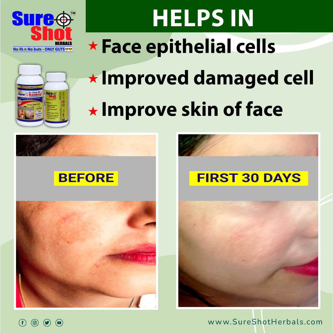 Dr.Garg's M.D. - Glow Samrat Tablets (100 Pcs) For Regenerating Face Epithelial Cell, Improve Damaged Cell, Improve Face Skin