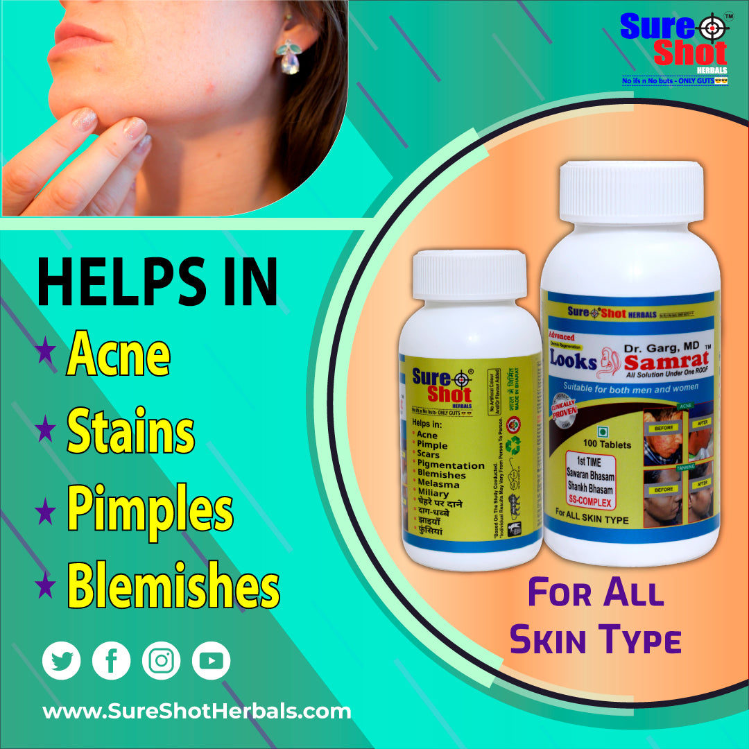 Dr.Garg's M.D. - Looks Samrat Tablets (100 Pcs) For Acne And Pimple, Scar, Pigmentation, Blemishes, Melasma, Miliary