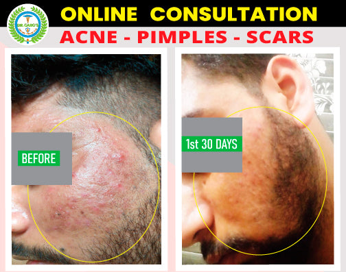 FACE CARE Combo Kit ( Glow Samrat + Roop Samrat + Looks Samrat ) Tablets