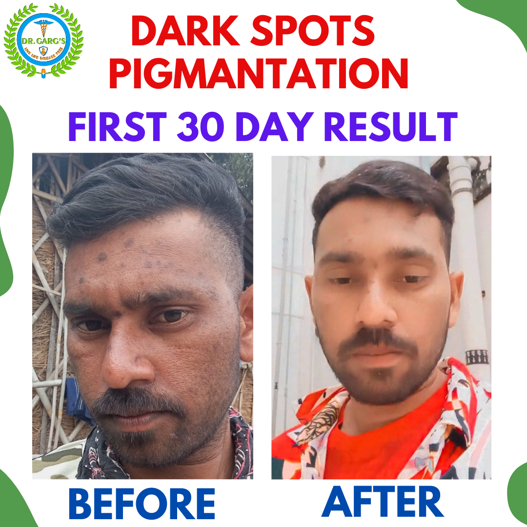 FACE CARE Combo Kit ( Glow Samrat + Roop Samrat + Looks Samrat ) Tablets