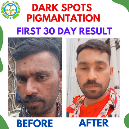 FACE CARE Combo Kit ( Glow Samrat + Roop Samrat + Looks Samrat ) Tablets