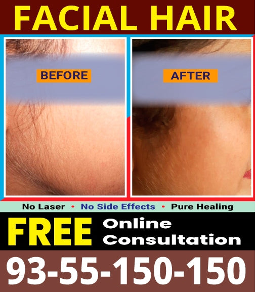 Dr.Garg's M.D.- Facial Hairs - Chin - Upper Lips - Hirsutism -