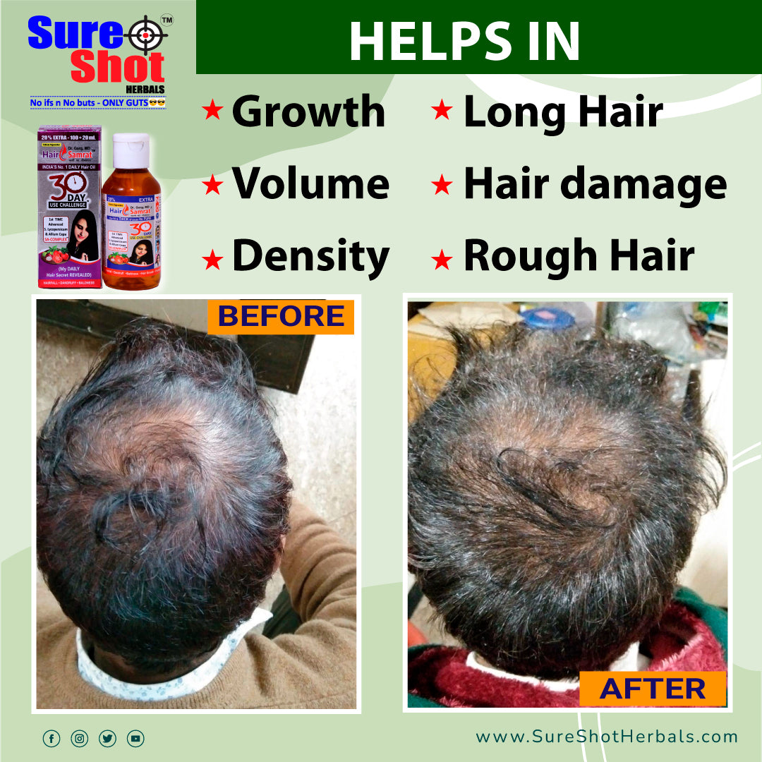Dr.Garg's M.D. -Hair Samrat - HairFall - Dandruff - Growth Of Hairs Volume, Density, Long Hair, Rough Dry